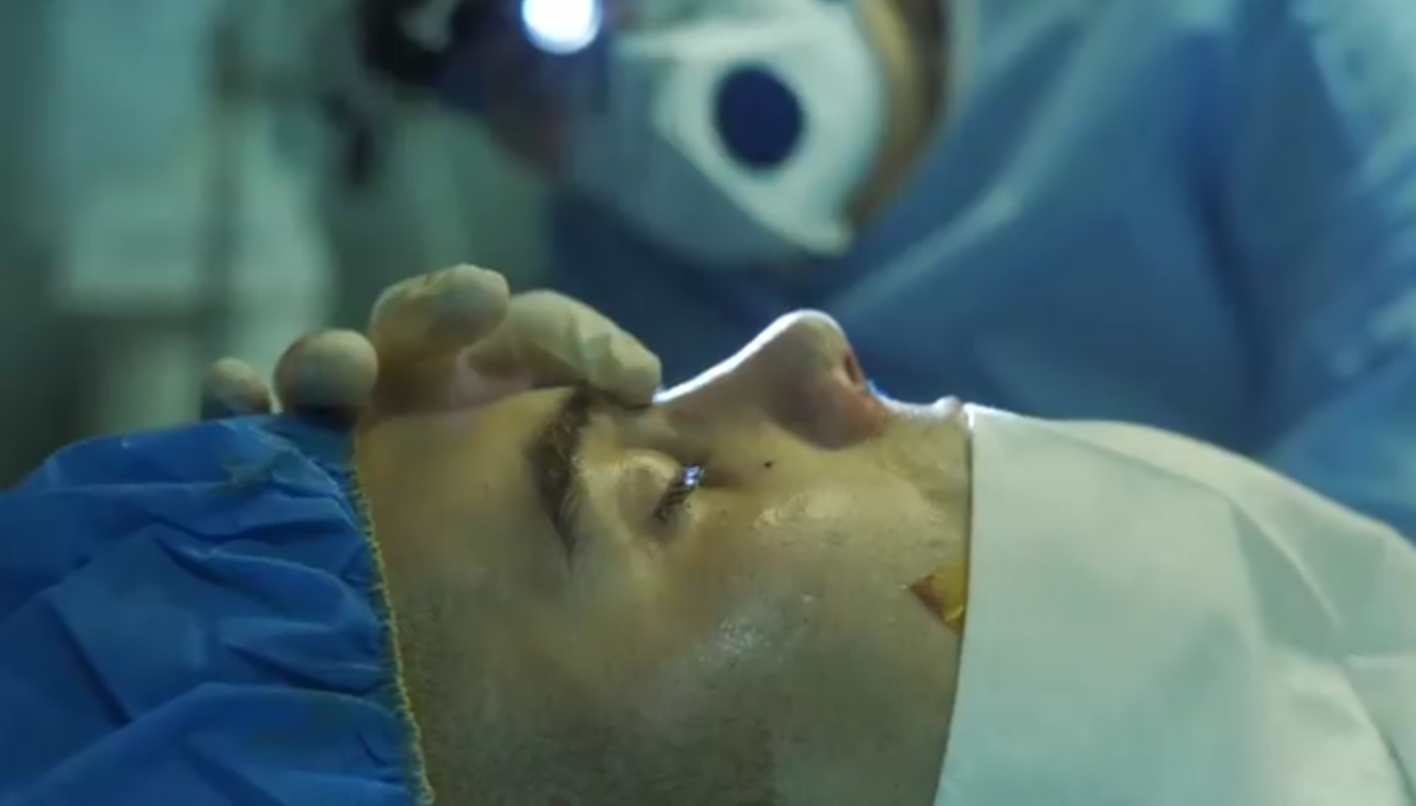 جراحی بینی مردانه دکتر حسام اسکندرزاده